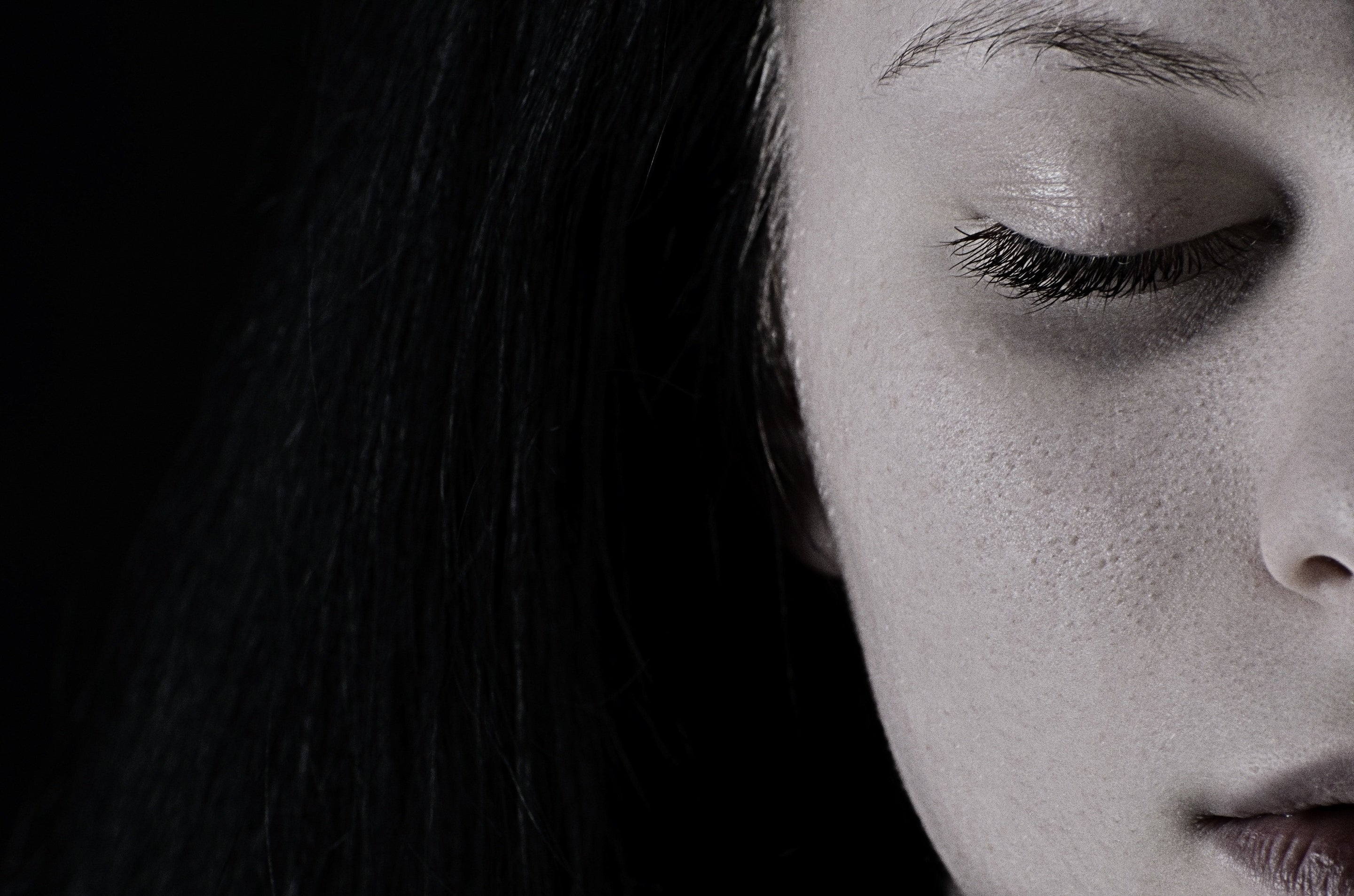 Hyperpigmentation peau noire : causes et solutions
