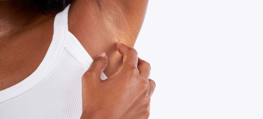 Aisselles foncées et taches entre les cuisses : causes, erreurs à éviter et solutions