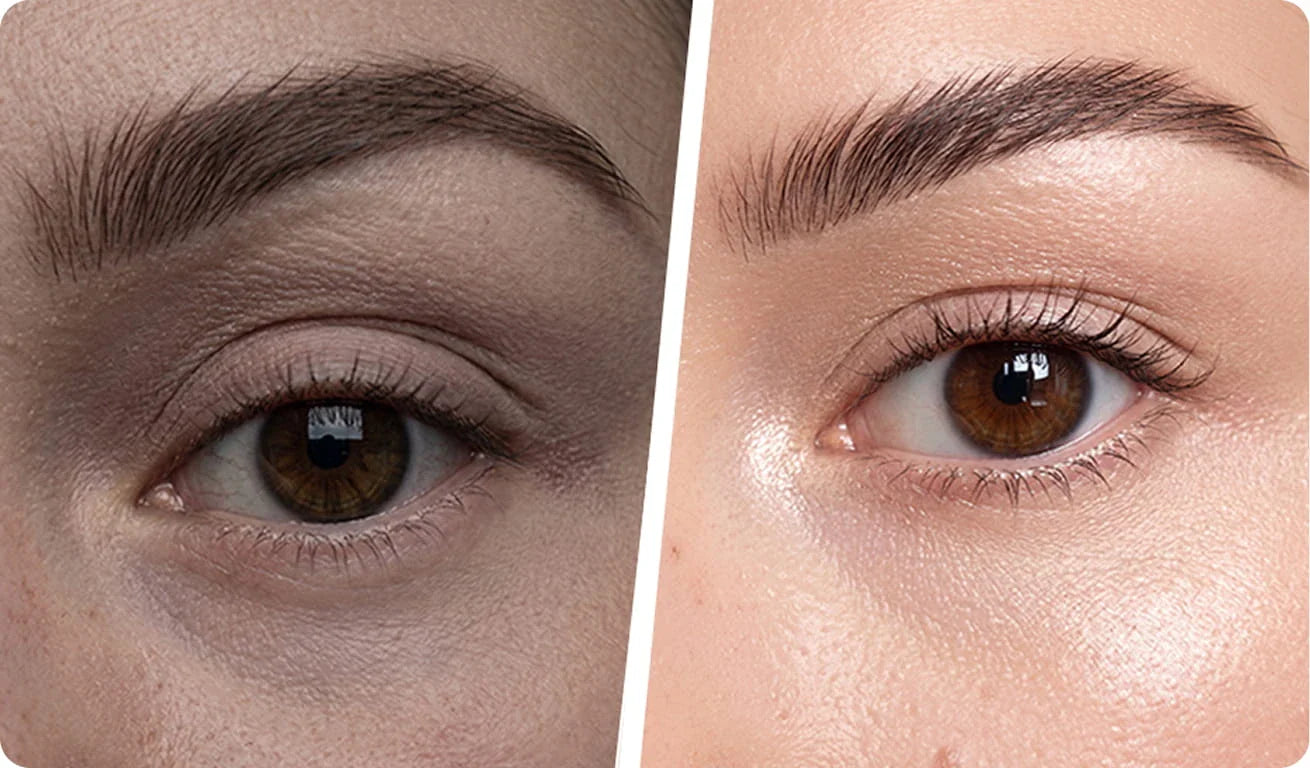 Meilleur patch yeux : comment reconnaître un patch anti-cernes efficace Image