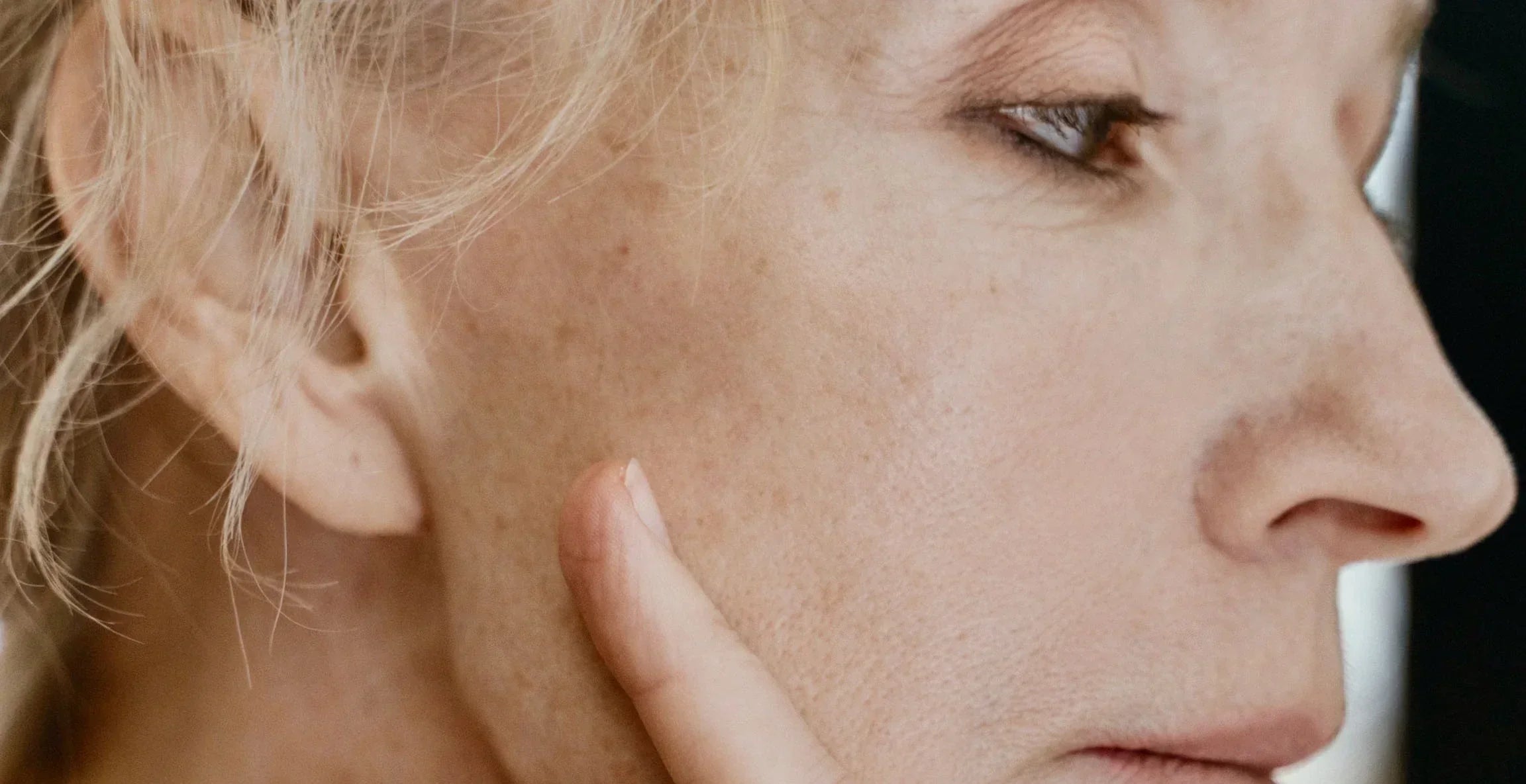 Comment enlever les taches brunes sur le visage : la méthode simple pour un teint plus uniforme