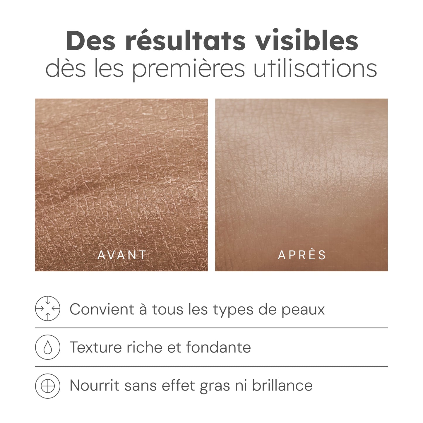 Anti-Spot Moisturizing Cream - 50g