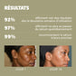 Anti-Imperfections Serum - 30ml