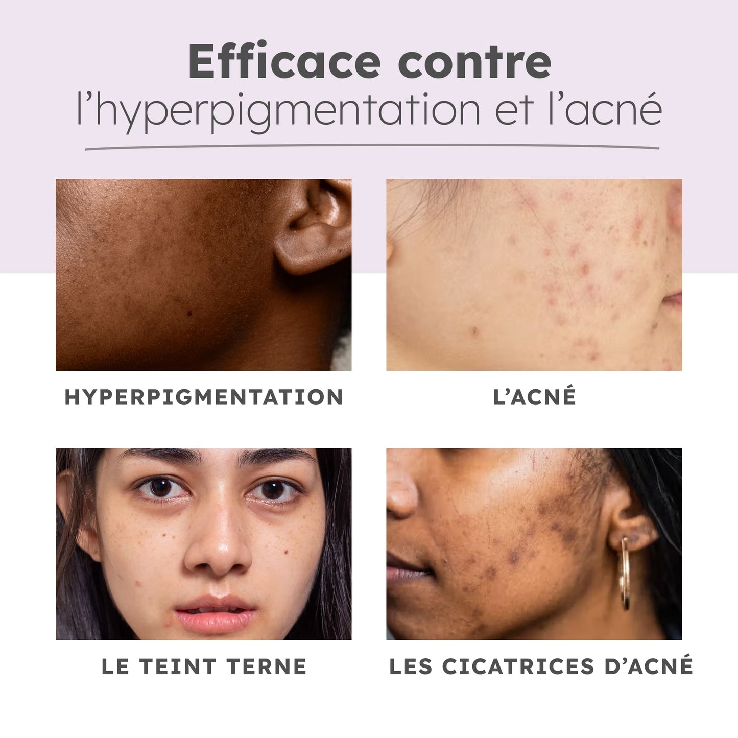 Ultra Glow - Routine 5 produits