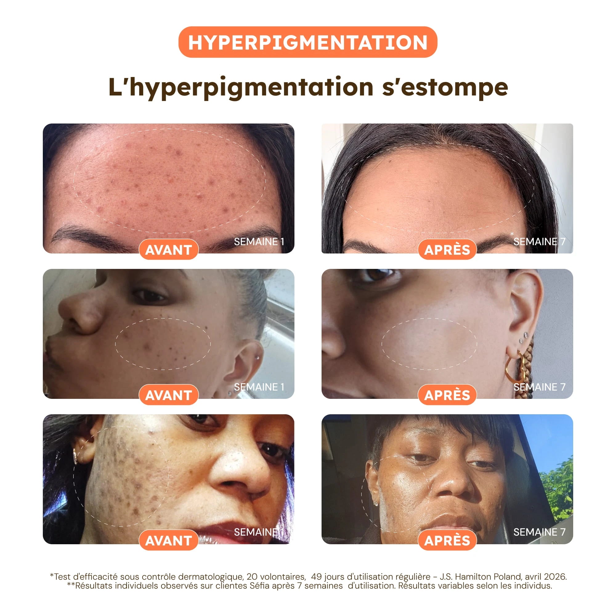 Anti-Blemish Cotton Pads