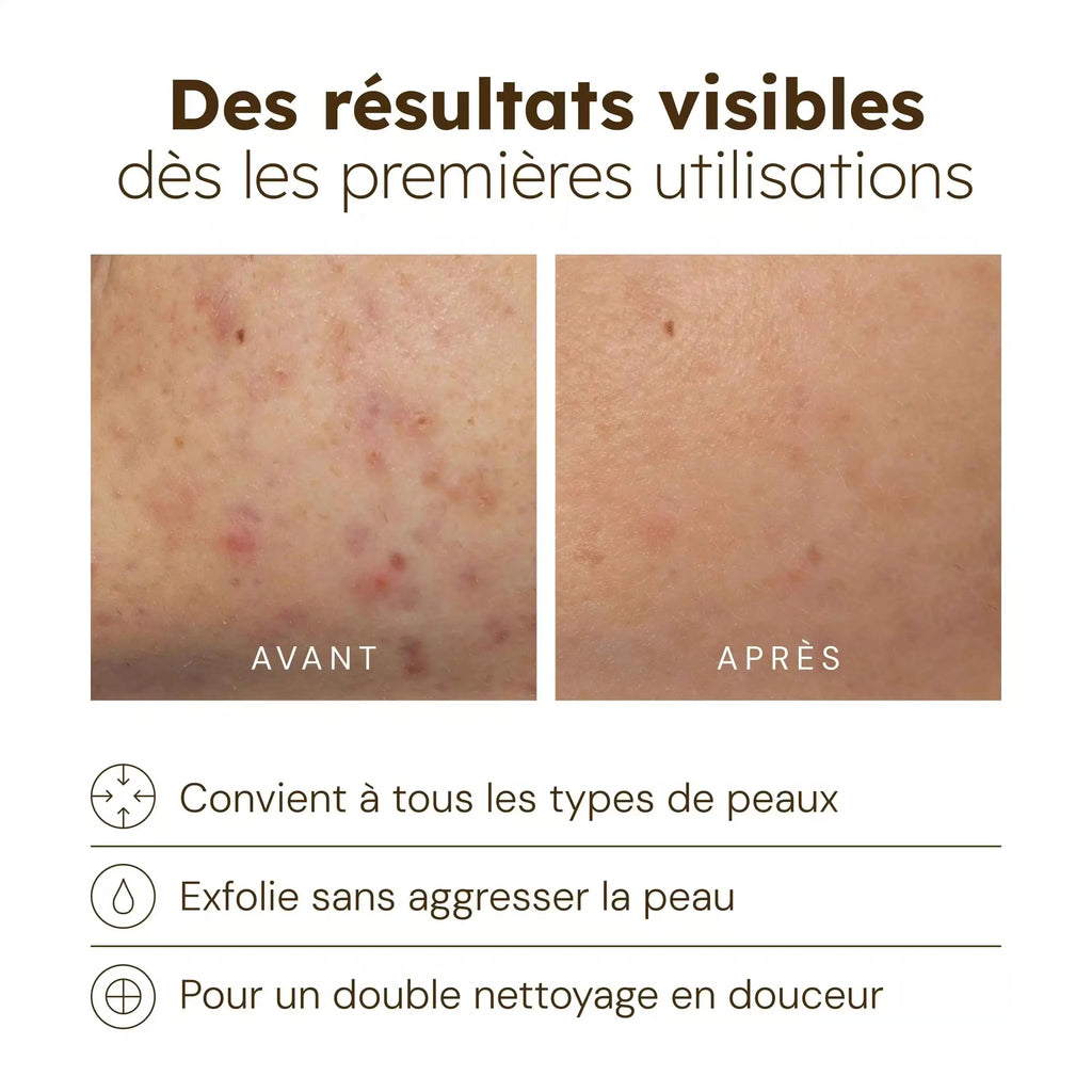 Nettoyant Éclat au Curcuma